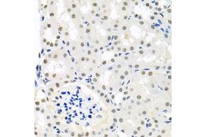Immunohistochemistry of paraffin-embedded mouse kidney using THOC1 antibody at dilution of 1:100 (x40 lens). (THOC1 anticorps)