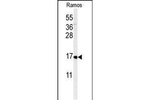 Western blot analysis of CMTM7 Antibody in Ramos cell line lysates (35ug/lane) (CMTM7 anticorps  (N-Term))