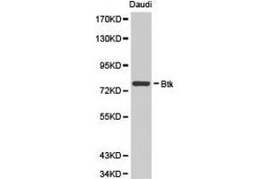 Western Blotting (WB) image for anti-Bruton Agammaglobulinemia tyrosine Kinase (BTK) antibody (ABIN1871367) (BTK anticorps)
