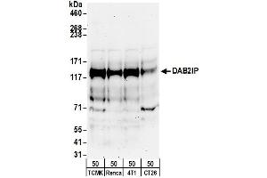 Western Blotting (WB) image for anti-DAB2 Interacting Protein (DAB2IP) (AA 850-900) antibody (ABIN7451726)