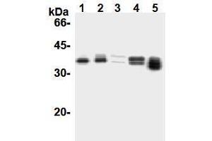 Western Blotting (WB) image for anti-Cyclin D1 (CCND1) antibody (ABIN1106871) (Cyclin D1 anticorps)