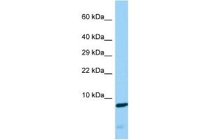 Host: Rabbit Target Name: CDC42SE2 Sample Type: COLO205 Whole Cell lysates Antibody Dilution: 1. (CDC42SE2 anticorps  (Middle Region))