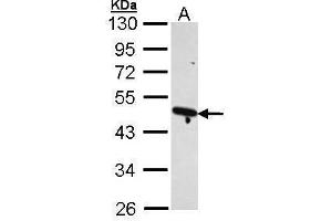 WB Image Sample (30 ug of whole cell lysate) A: H1299 10% SDS PAGE antibody diluted at 1:1000 (ACTR2 anticorps)