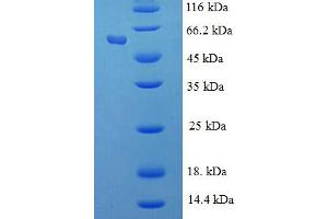 SDS-PAGE (SDS) image for Retinoblastoma Binding Protein 7 (RBBP7) (AA 1-425), (full length) protein (His-SUMO Tag) (ABIN5711301)
