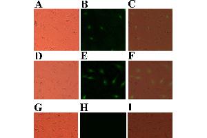 Indirect immunofluorescence analysis of the expression of His-tagged P247 and P523 in GF cells transfected with pCN247 and pCN523.