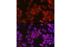 Immunofluorescence analysis of HeLa cells using CPT1A Rabbit pAb (ABIN6130129, ABIN6138976, ABIN6138977 and ABIN6220929) at dilution of 1:100 (40x lens). (CPT1A anticorps  (AA 497-756))