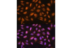 Immunofluorescence analysis of U2OS cells using SKP2 Rabbit pAb (ABIN6134430, ABIN6147822, ABIN6147824 and ABIN6223665) at dilution of 1:100.