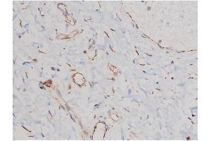 ABIN6267465 at 1/200 staining Human esophagus tissue sections by IHC-P.