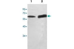 Western blot analysis of HepG2 cell (Lane 1) and human fetal testis (Lane 2) lysate with SCP2 polyclonal antibody  at 1 : 500 dilution. (SCP2 anticorps  (AA 303-536))