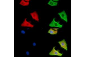 C12orf29 Antibody staining HepG2 cells by IF/ICC. (C12ORF29 anticorps)
