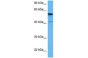Host:  Rabbit  Target Name:  PPP3CA  Sample Tissue:  Mouse Heart  Antibody Dilution:  1ug/ml