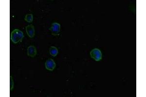 Immunofluorescent analysis of MCF-7 cells using ABIN7160242 at dilution of 1:100 and Alexa Fluor 488-congugated AffiniPure Goat Anti-Rabbit IgG(H+L) (SMAD5 anticorps  (AA 1-209))