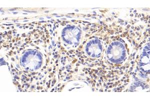 Detection of IL17 in Rabbit Colon Tissue using Monoclonal Antibody to Interleukin 17 (IL17)