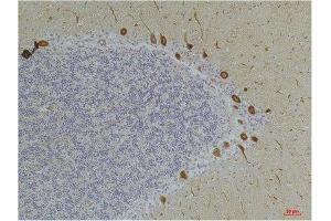 Immunohistochemistry (IHC) analysis of paraffin-embedded Human Brain Tissue using Ghrelin Receptor Rabbit Polyclonal Antibody diluted at 1:200. (GHSR anticorps)