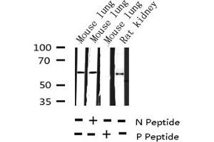 Western blot analysis of Phospho-G3BP-1 (Ser232) expression in various lysates