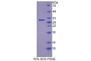 SDS-PAGE analysis of Rat OS9 Protein. (OS9 Protéine)