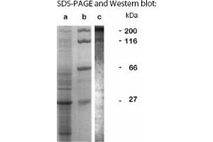 Western Blotting (WB) image for anti-LCCL Domain-Containing Protein CCP3 (LAP1) antibody (ABIN197620) (SRCR anticorps)
