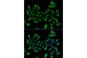 Immunofluorescence analysis of HeLa cells using ALAS1 antibody. (ALAS1 anticorps)