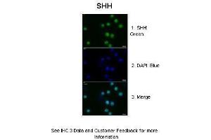 Sample Type :  Human glioma cells  Primary Antibody Dilution :  1:200  Secondary Antibody :  Anti-rabbit-GFP  Secondary Antibody Dilution :  1:500  Color/Signal Descriptions :  1.