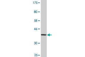 Western Blot detection against Immunogen (35. (USP9X anticorps  (AA 1-90))