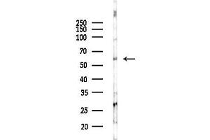 Western blot analysis of lysates from K562 cells(UV 30 min treatment), using CXCR7 Antibody at 1/1000 dilution.