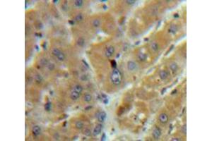 Used in DAB staining on fromalin fixed paraffin-embedded Liver tissue (TGFB1 anticorps  (AA 279-390))