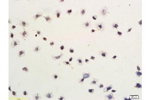 Gastric Cancer Cells labeled with Anti-Smac/DIABLO Polyclonal Antibody, Unconjugated (ABIN674619) followed by conjugation to the secondary antibody (DIABLO anticorps  (AA 131-239))