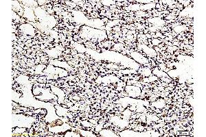 Formalin-fixed and paraffin embedded chicken lung labeled with Anti ApoER2 Polyclonal Antibody, Unconjugated (ABIN719426) at 1:200 followed by conjugation to the secondary antibody and DAB staining (LRP8 anticorps  (AA 851-963))