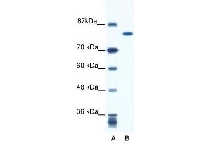 WB Suggested Anti-KIF23 Antibody Titration:  0. (KIF23 anticorps  (N-Term))