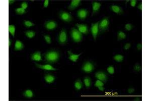 Immunofluorescence of monoclonal antibody to MAPK9 on HeLa cell.