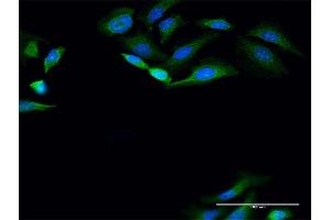 Immunofluorescence of purified MaxPab antibody to PANK4 on HeLa cell.