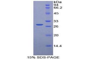 SDS-PAGE analysis of Rat Pyridoxal Kinase Protein. (PDXK Protéine)