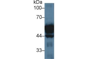 Western Blot; Sample: Rat Small intestine lysate; Primary Ab: 3µg/ml Rabbit Anti-Rat KRT20 Antibody Second Ab: 0. (KRT20 anticorps  (AA 75-382))