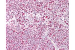 Anti-NFATC2 antibody IHC of human thymus.