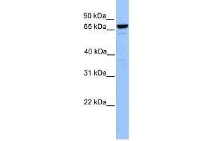 WB Suggested Anti-MTA2  Antibody Titration: 0. (MTA2 anticorps  (Middle Region))