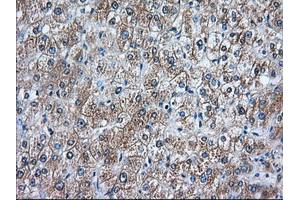 Immunohistochemical staining of paraffin-embedded Human prostate tissue using anti-RANGAP1 mouse monoclonal antibody.