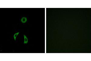 Peptide - +Western blot analysis of extracts from HUVEC cells, using FZD3 antibody. (FZD3 anticorps  (Internal Region))