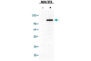 Western blot using ASAP3 polyclonal antibody  shows detection of ASAP3 in NIH/3T3 cells over-expressing the protein. (ASAP3 anticorps)