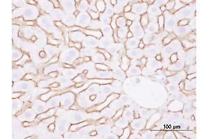 Immunohistochemistry (IHC) image for anti-Epidermal Growth Factor Receptor (EGFR) (C-Term) antibody (ABIN7448958) (EGFR anticorps  (C-Term))