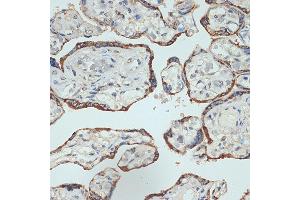 Immunohistochemistry of paraffin-embedded human placenta using Placental lactogen (CSH1) (CSH1) Rabbit mAb (ABIN7266353) at dilution of 1:100 (40x lens). (CSH1 anticorps)