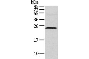 Gel: 12 % SDS-PAGE, Lysate: 40 μg, Lane: Human fetal intestines tissue, Primary antibody: ABIN7190229(CFC1 Antibody) at dilution 1/200 dilution, Secondary antibody: Goat anti rabbit IgG at 1/8000 dilution, Exposure time: 2 minutes (CFC1 anticorps)