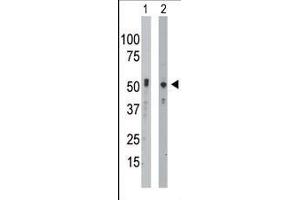 The anti-BCKDK Pab (ABIN391130 and ABIN2841253) is used in Western blot to detect BCKDK in mouse intestine tissue lysate (Lane 1) and Hela cell lysate (Lane 2).
