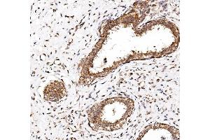 IHC analysis of NDP52/CALCOCO2 using anti-NDP52/CALCOCO2 antibody (ABIN7599401). (CALCOCO2 anticorps  (AA 1-446))
