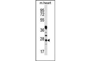 Western blot analysis of Beta-crystallin A3 Antibody  in Mouse heart tissue lysates (35ug/lane).