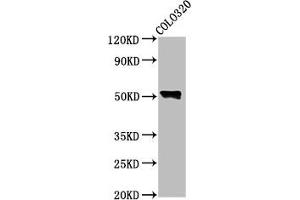 Western Blot Positive WB detected in: Colo320 whole cell lysate All lanes: WAS antibody at 4.
