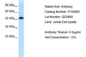 Lane: Jurkat cell LysateAntibody Dilution: 0. (Anti-MBP-1 (Middle Region) anticorps)