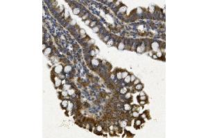 IHC analysis of REA/PHB2 using anti REA/PHB2 antibody (ABIN7599240).