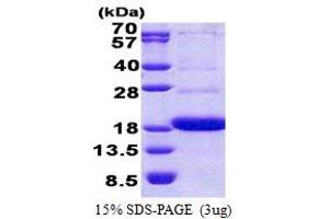SDS-PAGE (SDS) image for CD300a (CD300A) (AA 18-128) protein (His tag) (ABIN5853118)