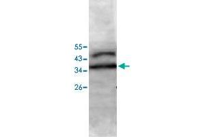 Western blot analysis of Jurkat cell lysate with PECI polyclonal antibody  at 1 : 500 dilution. (PECI/ECI2 anticorps  (AA 2-227))