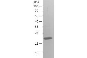 Western Blotting (WB) image for Indian Hedgehog (IHH) (AA 28-202) protein (His tag) (ABIN7123415)
